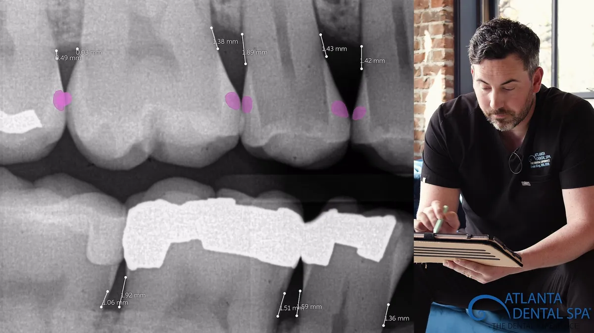 Dr King Using Latest Dentistry AI Technology To Confirm Dental Health